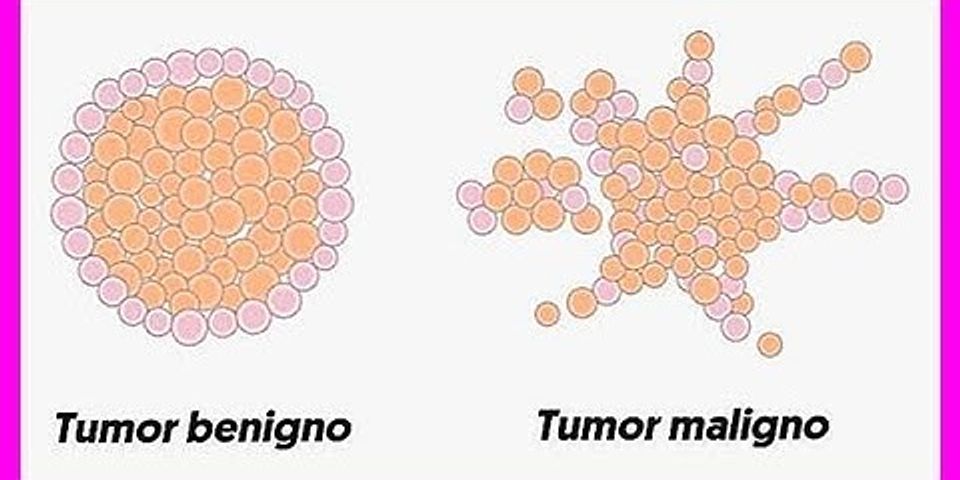 Was ist der unterschied zwischen einem tumor und einem kres