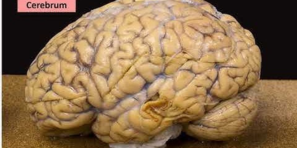 Which lobe of the brain is located in the top rear of the brain?